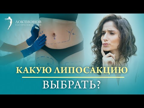 Видео: Что такое липосакция? | Современные виды липосакции | Какой вид липосакции лучше выбрать