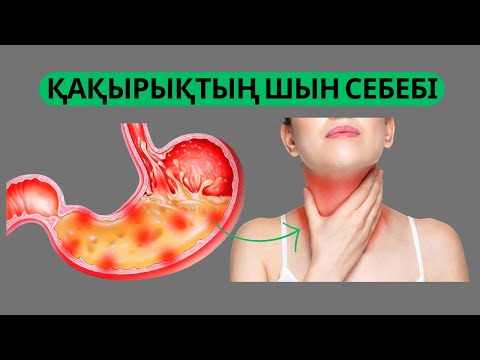 Видео: ТАМАҚТАҒЫ СОЗЫЛМАЛЫ ҚАҚЫРЫҚТЫҢ ЕШКІМ БІЛМЕЙТІН СЕБЕБІ | ЕСТІМЕГЕН ЕЛДЕ КӨП | СҰМДЫҚ ЖАҒДАЙ