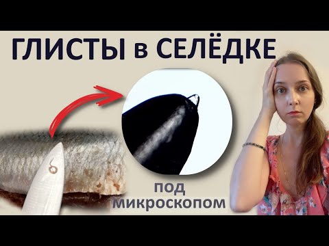 Видео: Множество паразитов в солёной селёдке.  Как такое есть ??