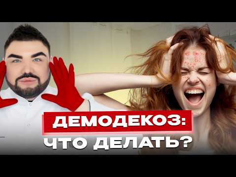 Видео: Демодекоз: как избавиться от подкожного клеща? Советы врача-косметолога