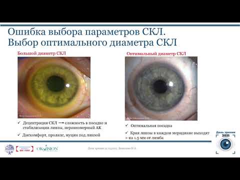 Видео: Бакалова Н.В. - Основные проблемы при подборе СКЛ и управление ими