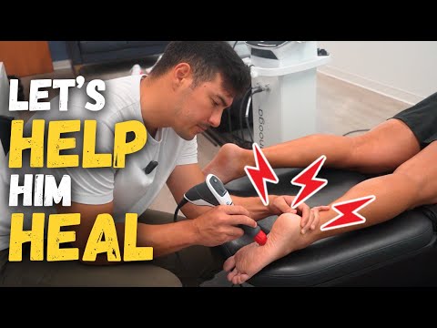 Видео: У него болят ноги! Лечение и упражнения при подошвенном фасциите || Хиропрактика с доктором Тайлером