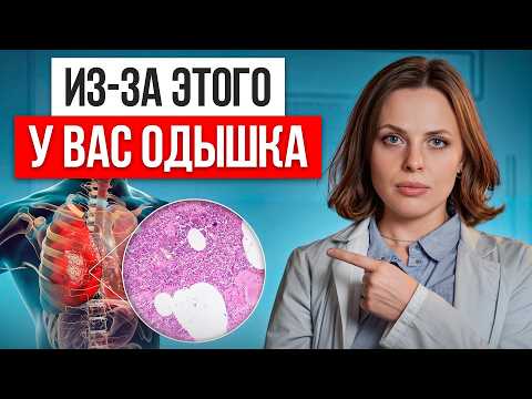 Видео: Сделайте ЭТО и одышка УЙДЕТ! / Как ЛЕГКО избавиться от одышки и что ее провоцирует?