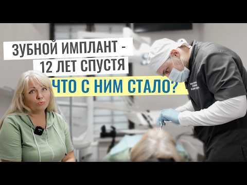 Видео: Имплант спустя 12 лет: ЧТО с ним стало? Реальный пример и мнение пациентки