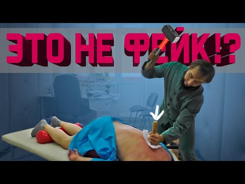Видео: Как удар молотком по спине спасает от боли?