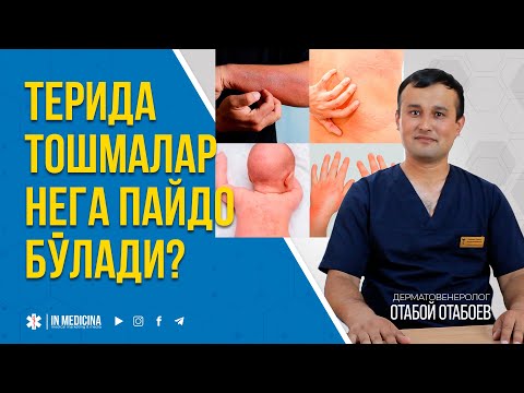 Видео: Терида Тошмалар Нега Пайдо Бўлади? #inmedicina  #toshmalar #alergia