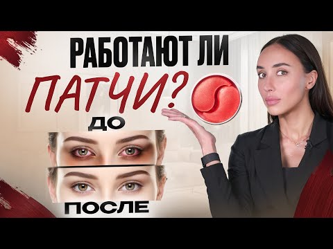 Видео: Стоит ли тратить деньги на патчи?