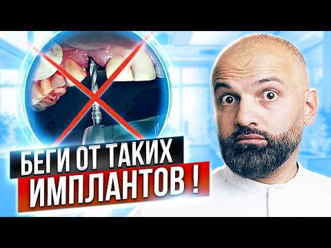 Видео: НИКОГДА не ставь ТАКИЕ импланты! Стоматологи молчат об этом! Вся правда об имплантации зубов