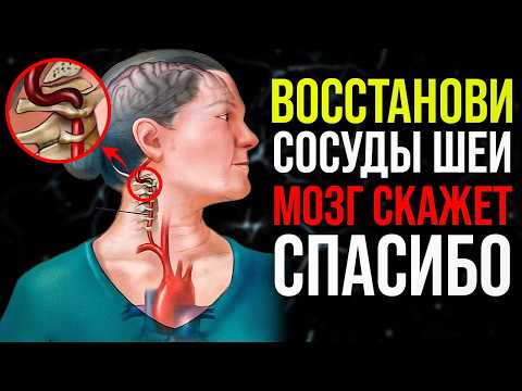 Видео: Боль в шее — угроза для МОЗГА! 1 упражнение = 100% результат!