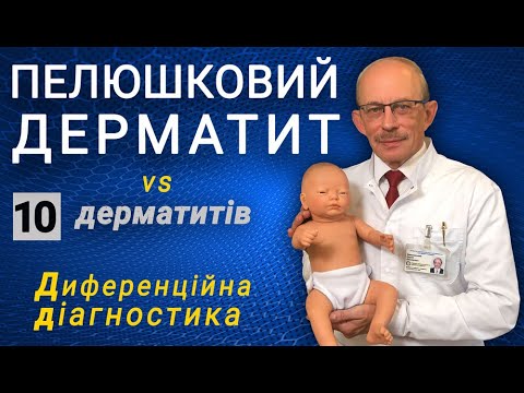 Видео: Пелюшковий дерматит - диференційна діагностика, лікування, фото, причини, мазь