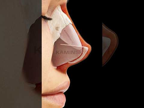 Видео: Вздёрнутый нос и его коррекция ⭕️ KAMINSKYI