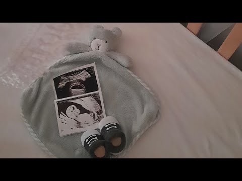 Видео: Мои будни.🌼Отвечаю на советы🌼Супер крем.🌼ГВ Колики Аллергия