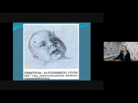 Видео: Гемолитическая болезнь новорожденных