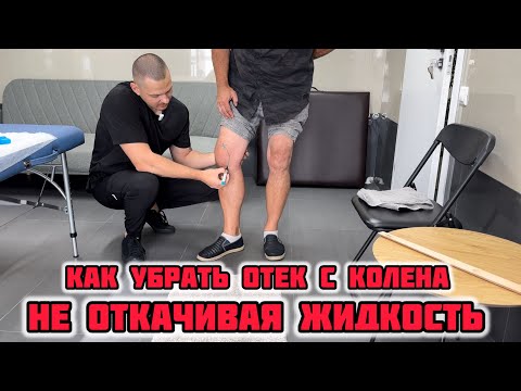 Видео: Как убрать отек с колена не откачивая жидкость?! Травма колена. Часть 1