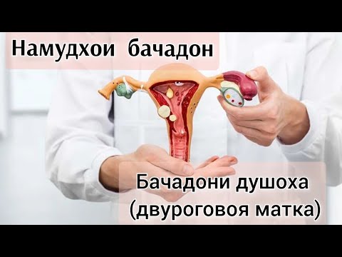 Видео: Чаро бачадон Душоха мешавад? Хомиладори бо бачадони Душоха