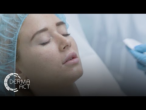 Видео: Поставяне на филър за устни Restylane®