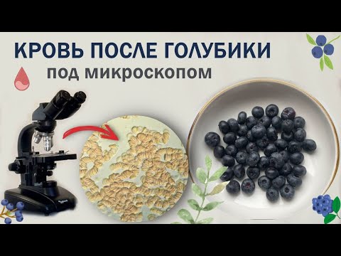 Видео: Как съеденная голубика повлияет на состояние крови.