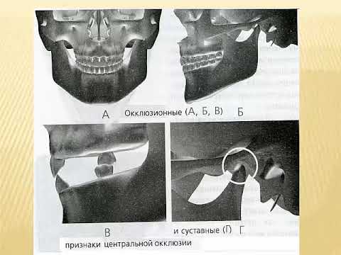 Видео: Артикуляция и оклюзия