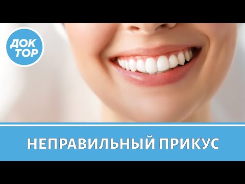 Видео: Врач-ортодонт объяснил, к чему может привести неправильный прикус