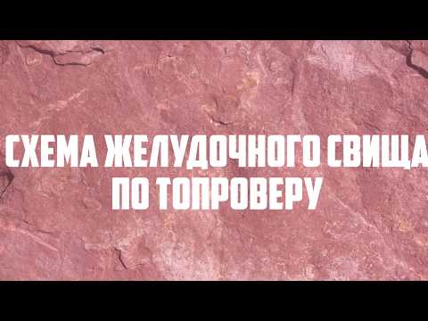 Видео: Схема желудочного свища по Топроверу