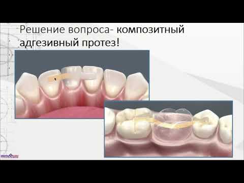 Видео: Вебинар Волков Д.П. Стекловолоконные балочные конструкции. (30.04.2019)