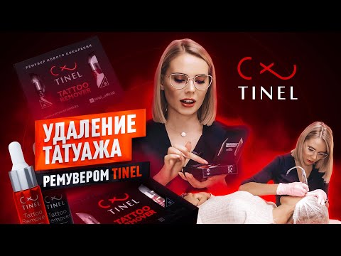 Видео: Удаление татуажа ремувером Tinel