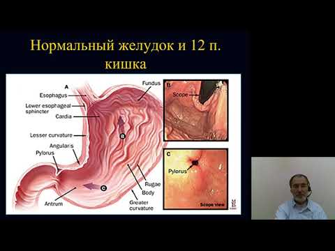 Видео: Лучевая диагностика 4.Лучевое исследование желудочно кишечного тракта