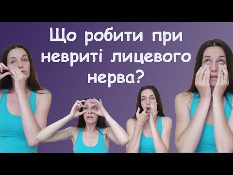 Видео: Неврит лицевого нерва лікування - масаж, вправи. Лічниця сестер Похмурських