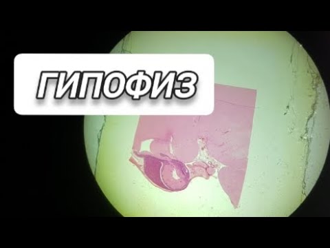 Видео: #гипофиз