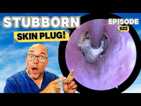 Видео: УПРЯМЫЙ КОЖНЫЙ ПЛАН! Эпизод 522