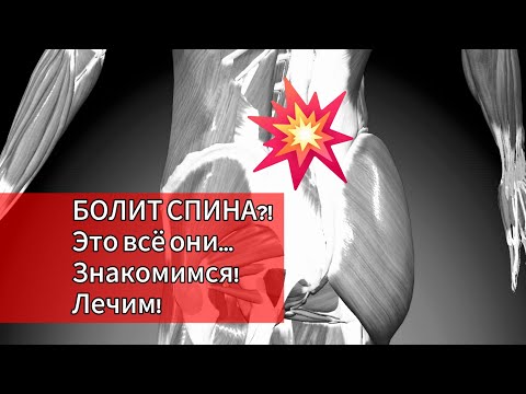 Видео: БОЛИТ ПОЯСНИЦА?! Это всё они... Знакомимся! ЛЕЧИМ!