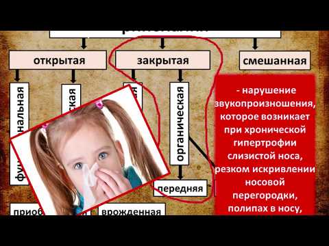 Видео: 12 Ринолалия  Причины  Основные формы