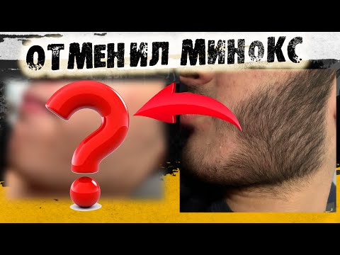 Видео: 3 месяца без Минокса. Что стало с бородой после отмены? Андрей борода Выпуск №23