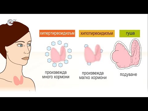 Видео: Кандида и Хашимото - бичът на съвременния човек
