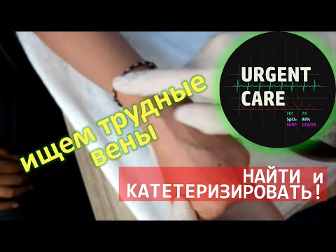 Видео: Трудные вены. Хитрости и техника