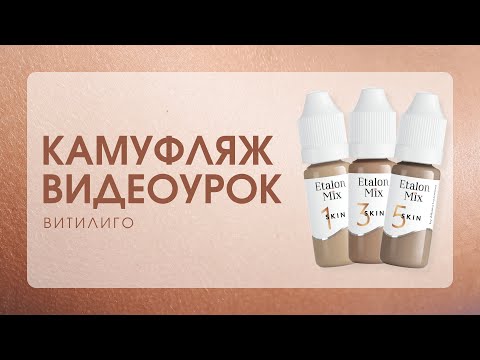 Видео: ВИДЕОУРОК: Камуфляж витилиго | Etalon Mix by Albina Lazareva