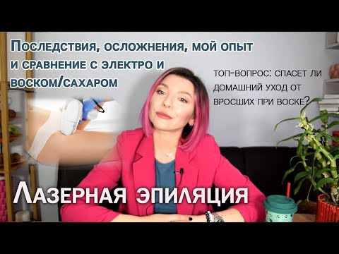 Видео: ЛАЗЕРНАЯ ЭПИЛЯЦИЯ: надолго ли эффект, мой опыт в сравнении с электро, воском и сахаром.