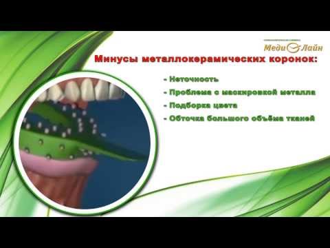 Видео: МедиЛайн ТВ. Коронки из диоксида циркония