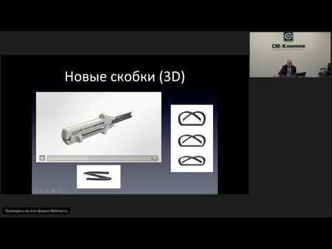 Видео: Волшебный мир сшивающих аппаратов