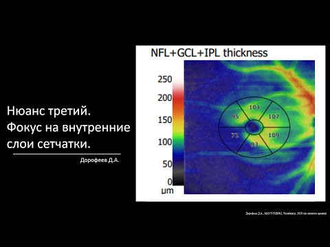 Видео: Нюанс третий. Фокус на внутренние слои сетчатки.