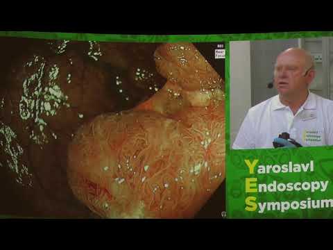 Видео: 03Live Мальков ВА Видеокапсула Capsovision