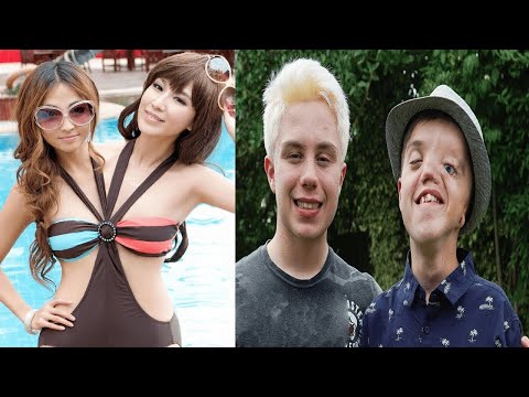 Видео: Эти редкие близнецы удивят даже взрослых!