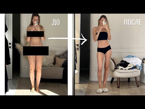 Видео: ОТЁКИ. МИНУС 9 СМ ЗА НЕДЕЛЮ. МОЯ ИСТОРИЯ | ЗОНДИРОВАНИЕ