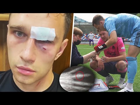 Видео: САМЫЕ СТРАШНЫЕ ТРАВМЫ НА ФУТБОЛЬНОМ ЮТУБЕ / 3 ЧАСТЬ