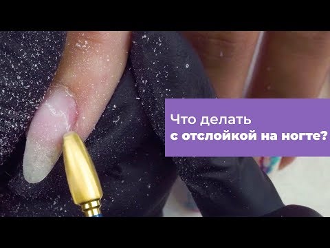Видео: Как НАЙТИ И ОБРАБОТАТЬ "ОТСЛОЙКУ" на ногте? (коррекция ногтя)