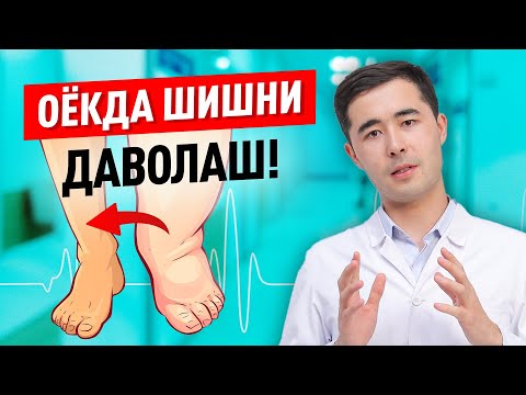 Видео: ОЁКДА ШИШЛАР САБАБИ ВА УЙДА ДАВОЛАШ