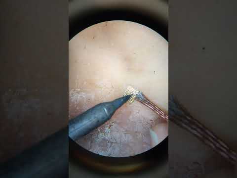 Видео: Правильно перекатываем микросхемы.