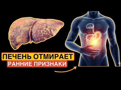 Видео: 14 ранних Признаков того, что ваша ПЕЧЕНЬ ОТМИРАЕТ. 90% с проблемам…