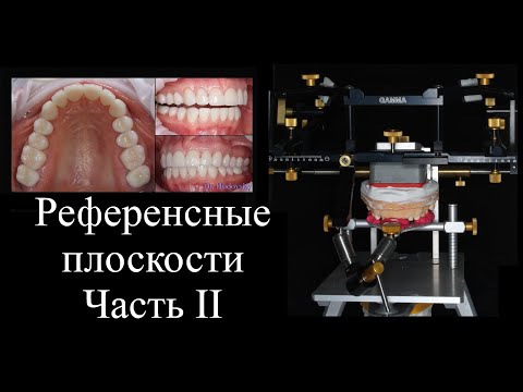 Видео: Референсные плоскости. Приёмы для переноса данных в артикулятор