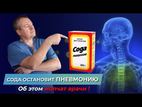 Видео: Об этом молчат врачи - СОДА остановит ПНЕВМОНИЮ! Как вылечиться без лекарств? Пневмония